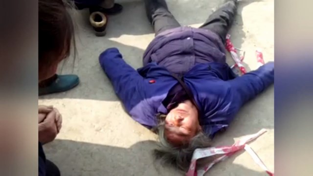 A believer was seriously injured