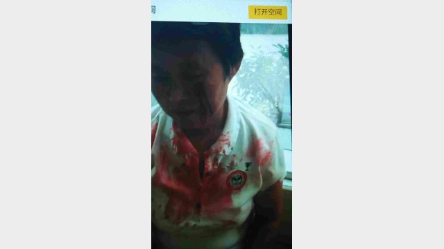 One of the injured villagers