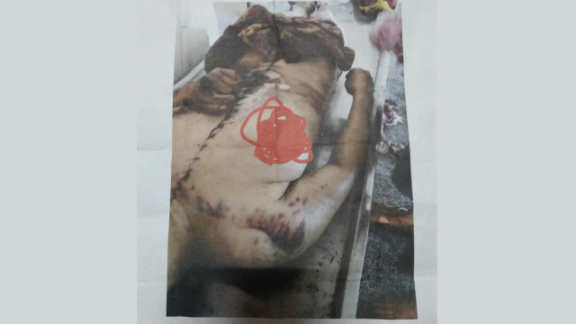 There is a long line of stitches from throat to pelvis running along Lü Zhonghua’s corpse