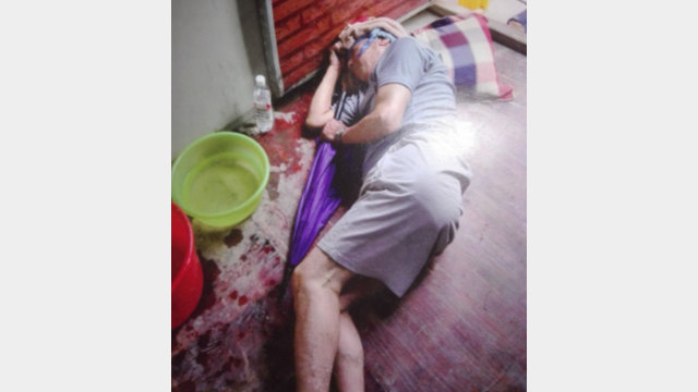 A villager is beaten, causing bleeding on the head