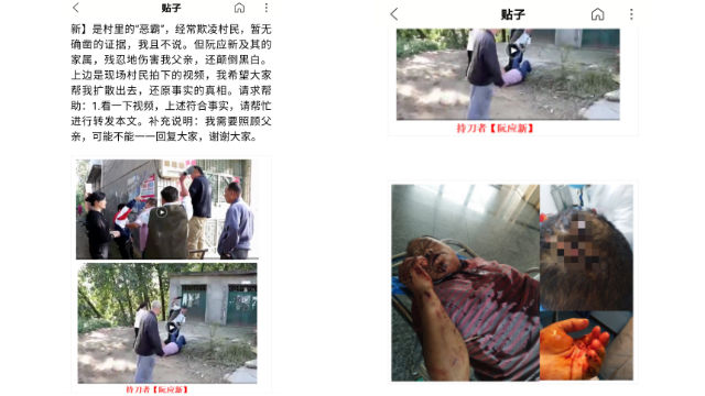 Ruan Yingxin injured Lei Debin with a knife